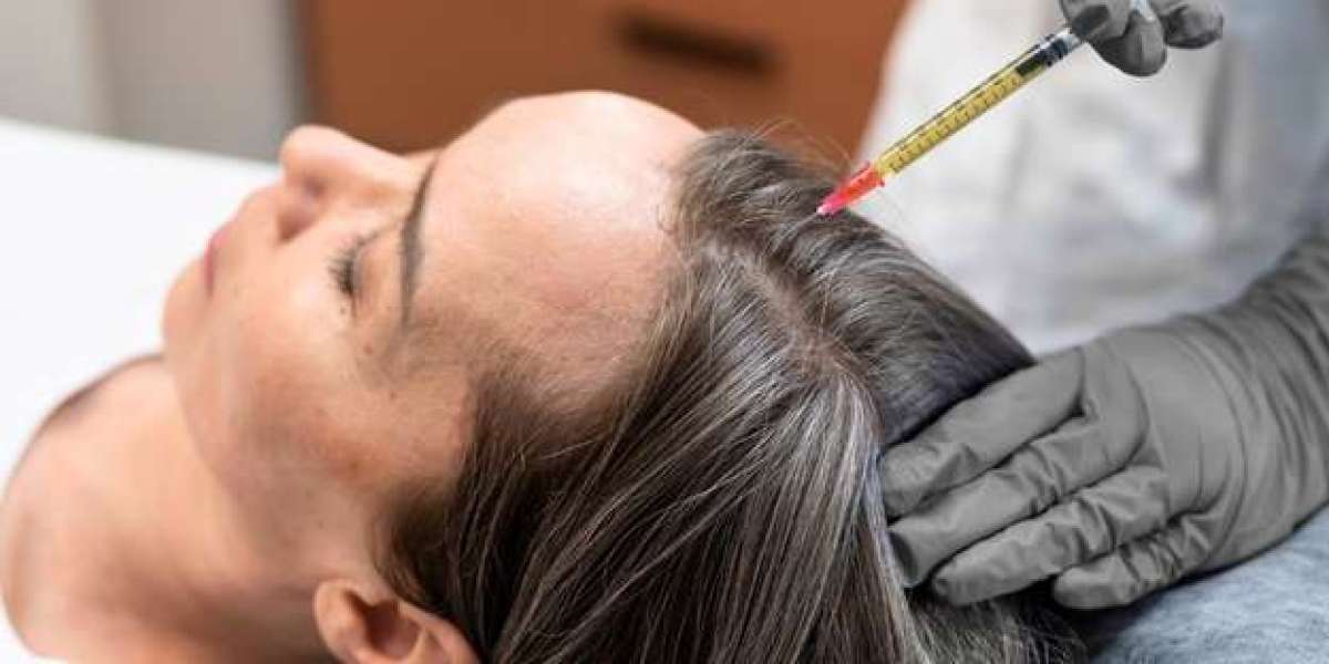 Exosome Hair Therapy: The Fastest Way to Achieve Fuller Hair