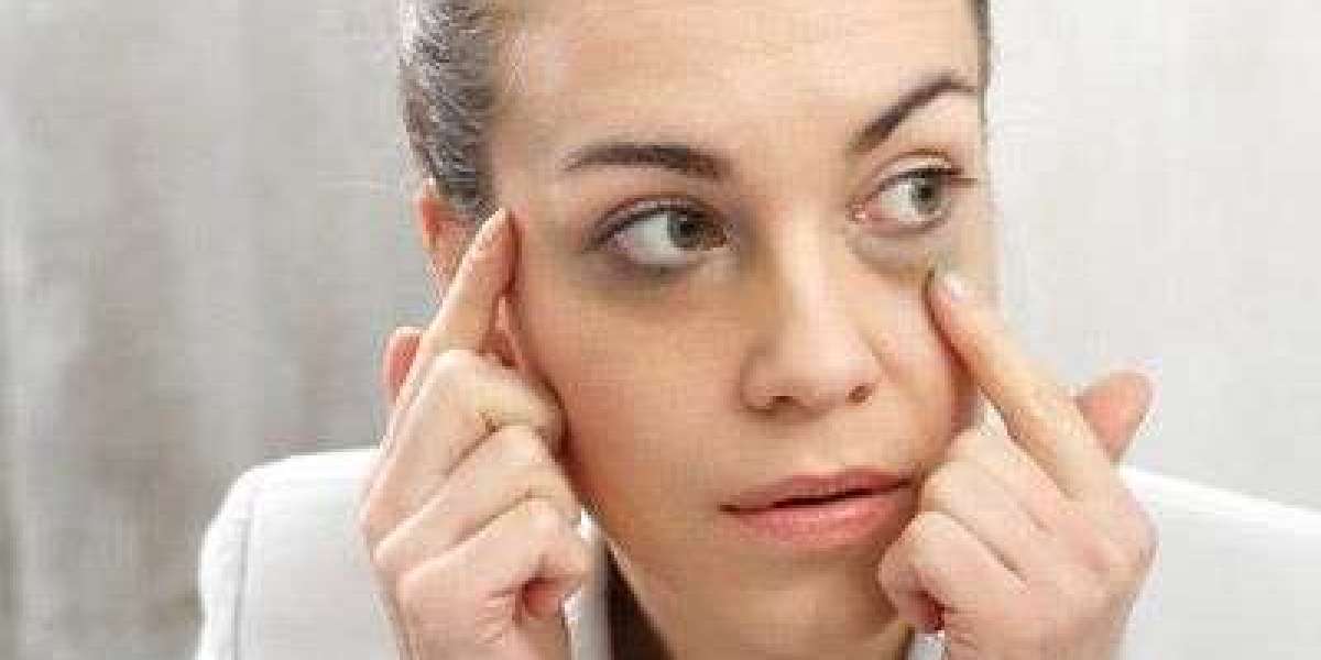 Fast and Safe Dark Circles Treatment Options