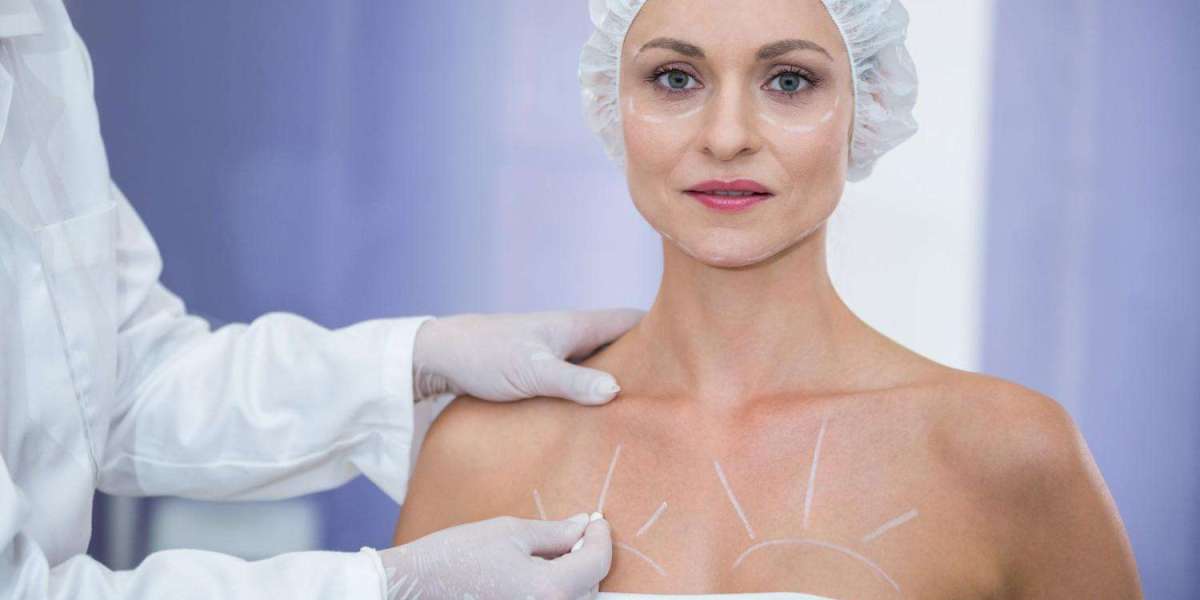 Breast Augmentation Surgery in Dubai | Best Plastic Surgeon in Dubai
