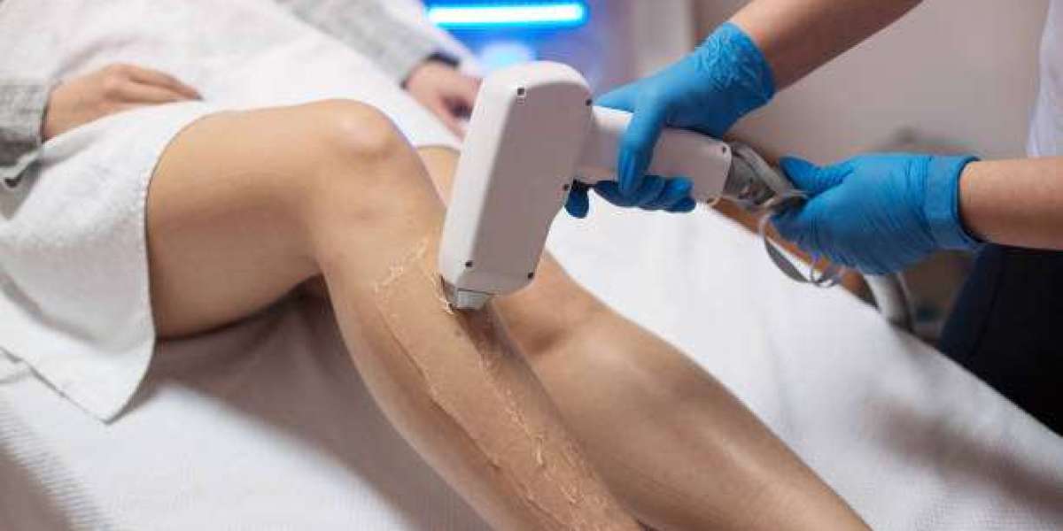 Effortless Hair-Free Skin with Advanced Laser Treatments