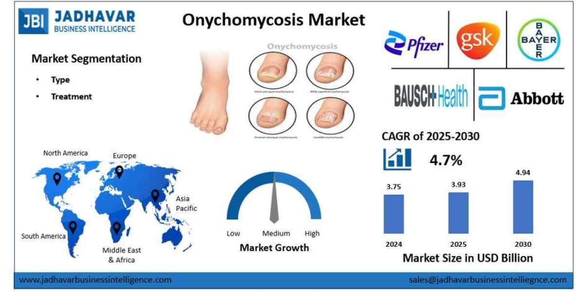 Onychomycosis Market: Rising Infection Rates Driving Treatment Adoption
