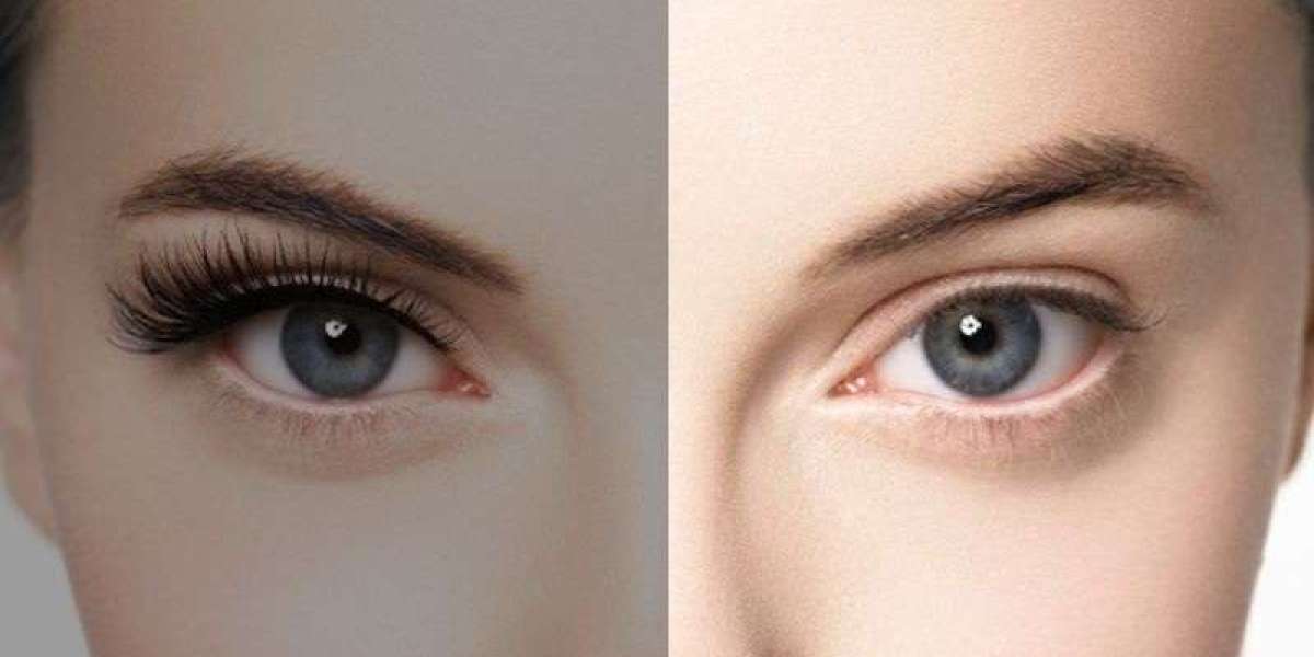 Skin Whitening Treatment Dubai: Step by Step Guide