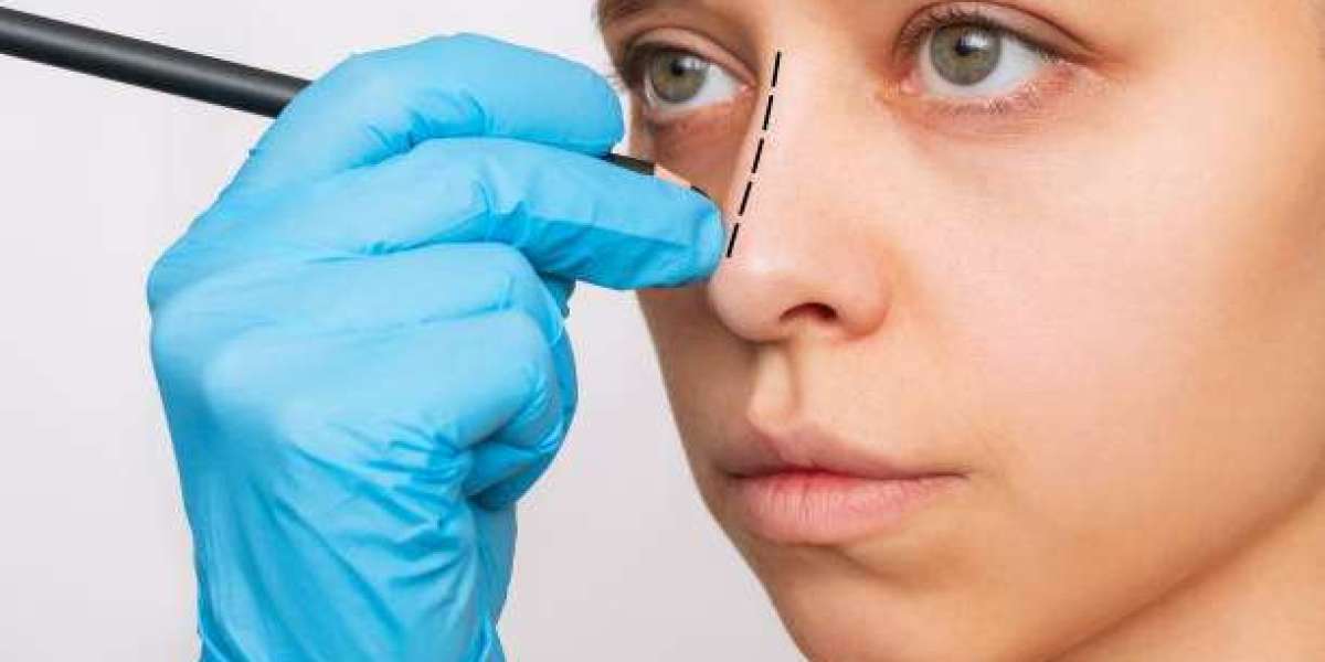 رحلة العام: الجدول الزمني الكامل لظهور نتائج جراحة تجميل الأنف