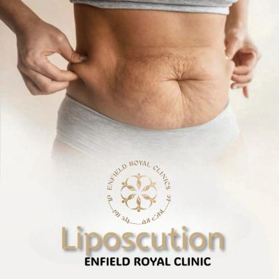 Liposuction in Islamabad Pakistan