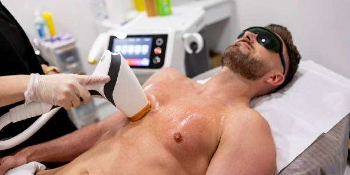 Laser Hair Removal in Islamabad – Effective Hair Reduction for Smooth Skin