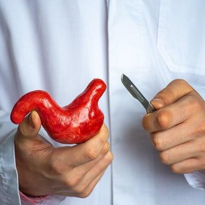 Bariatric Surgery in Islamabad - ERC