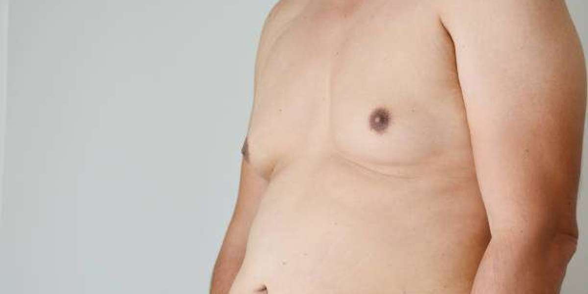 Professional Gynecomastia Treatment for Men in Islamabad