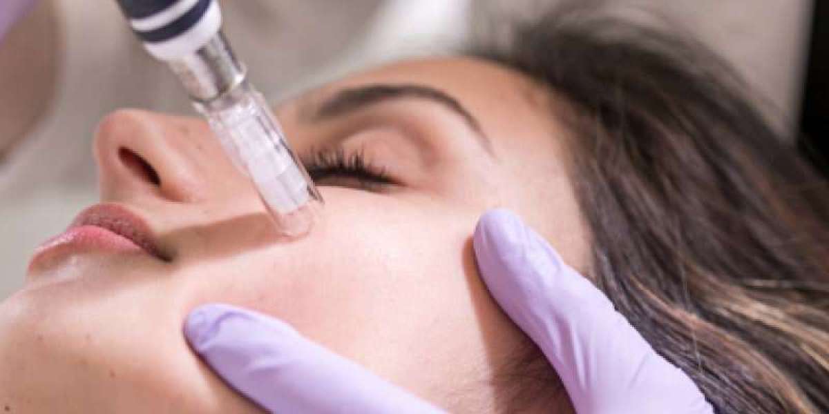 Trusted Acne Scar Treatment Doctors in India - Minimally Invasive Scar Removal Techniques | Essence Skin Care