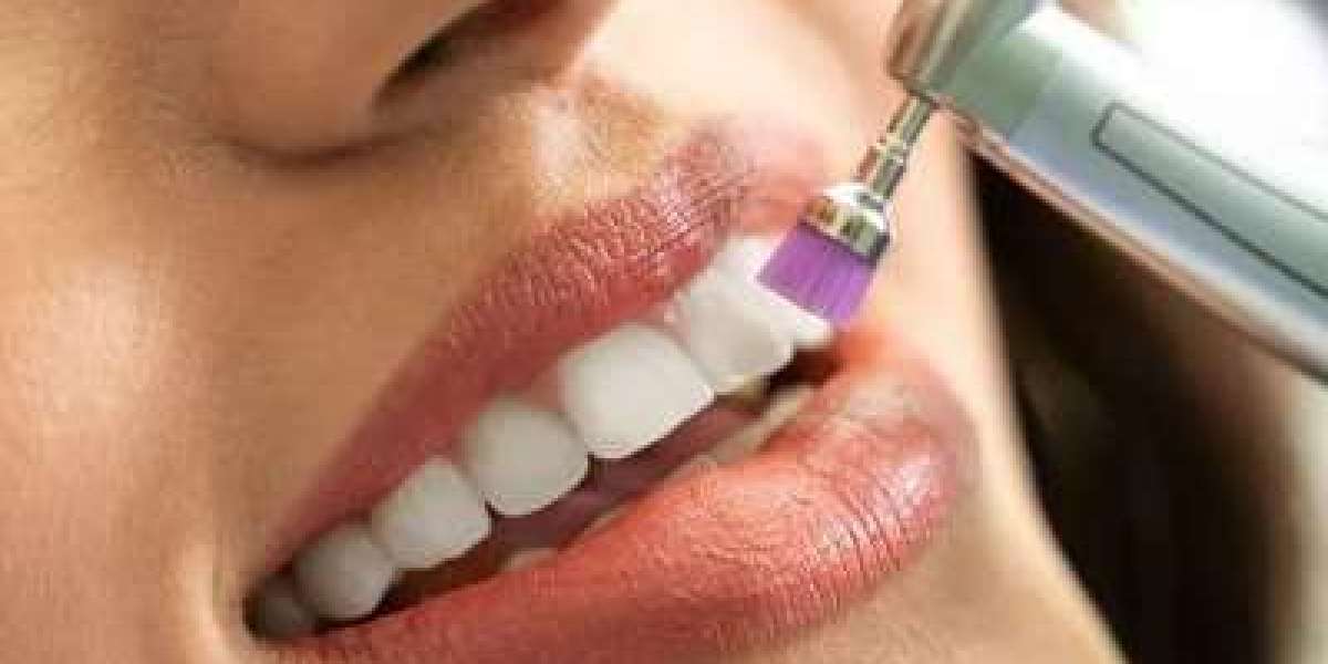 Why Dentists Recommend Teeth Scaling and Polishing in Islamabad