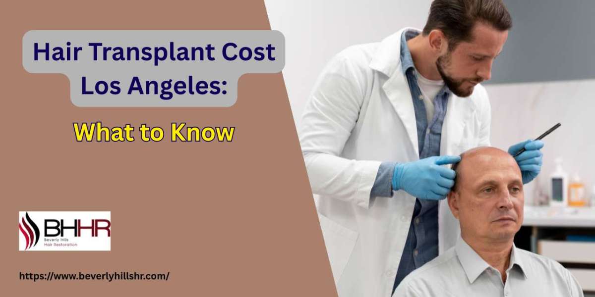 Hair Transplant Cost Los Angeles: What to Know