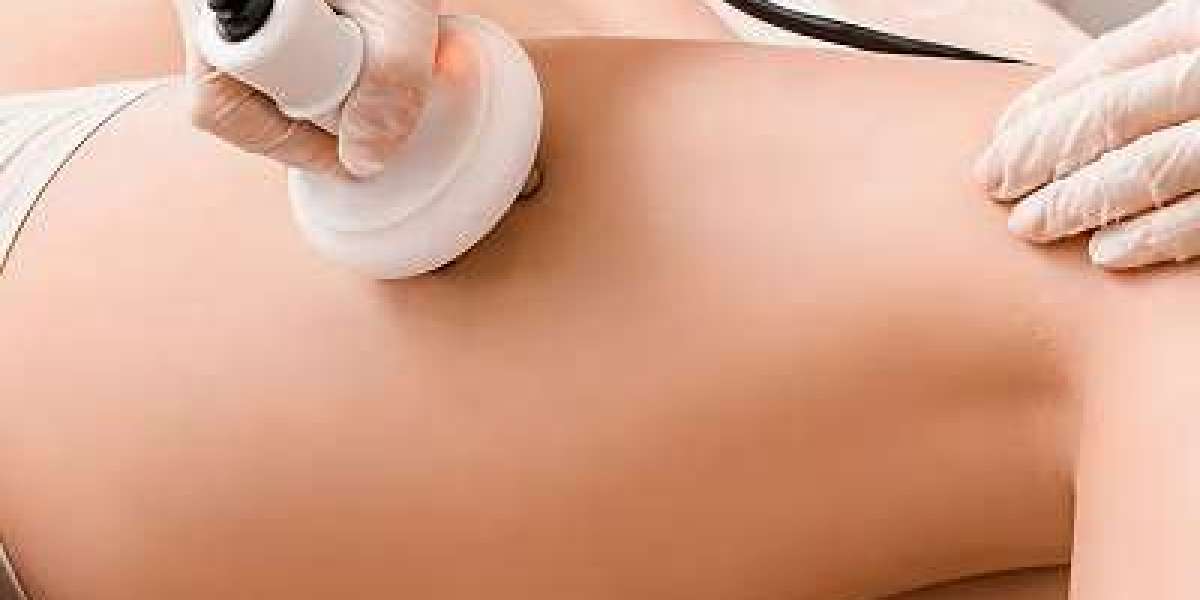 Venus Legacy Treatments Targeted Fat Reduction in Riyadh