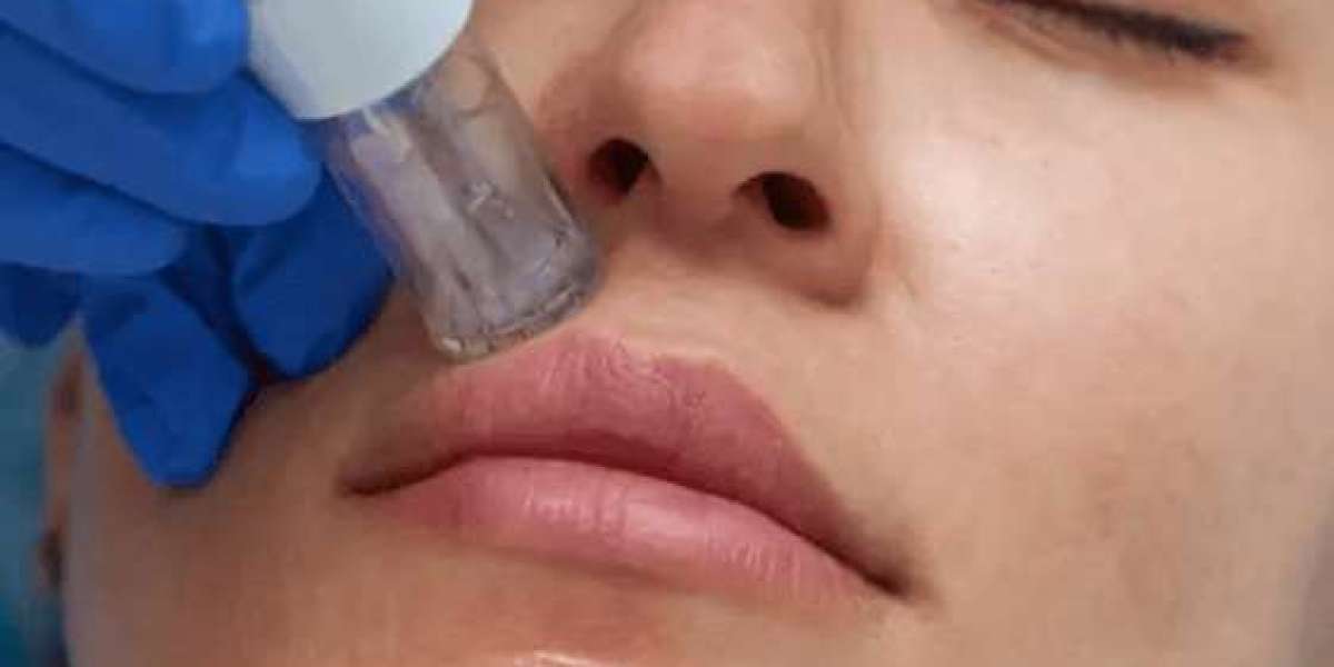 Face Rejuvenation in Jeddah Tailored to Your Skin Needs