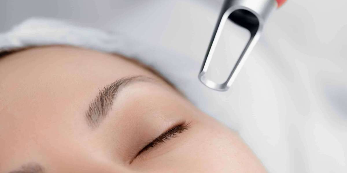Pico Laser Treatment in Dubai for Stubborn Pigmentation: How It Works