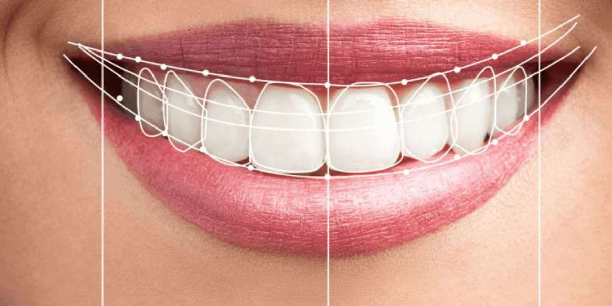 Digital Smile Design Dubai for Personalized Smile Transformations