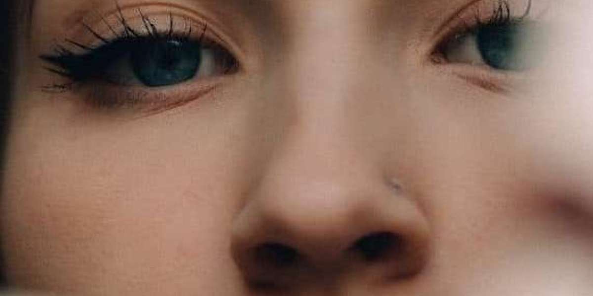 Rhinoplasty: Before and After Expectations