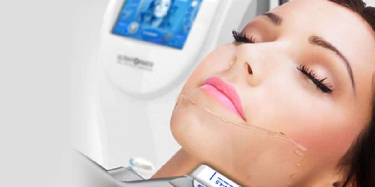 HIFU Treatment in London – Non-Invasive Ultrasound Skin Tightening