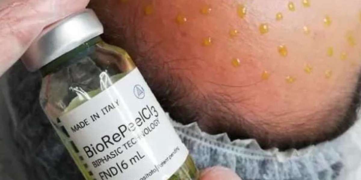 BioRePeel Treatment in Dubai for Uneven Skin Texture and Large Pores