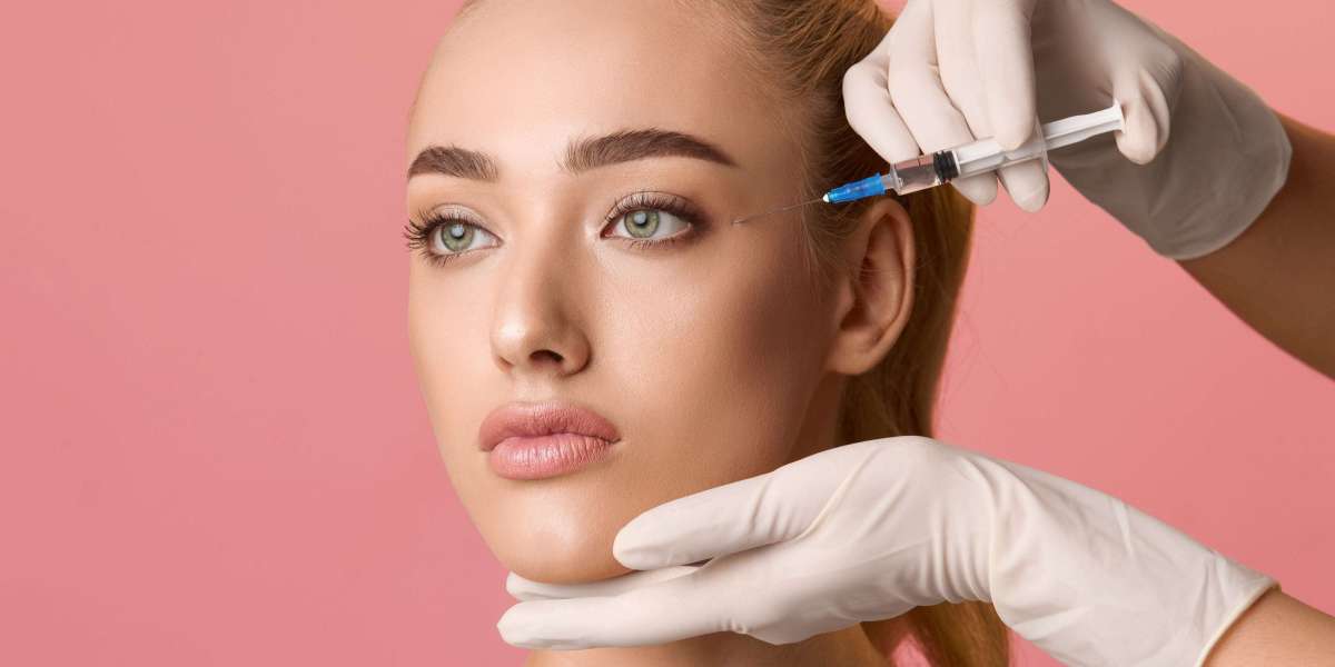 Sculptra for Hollow Cheeks and Temples: A Natural Approach