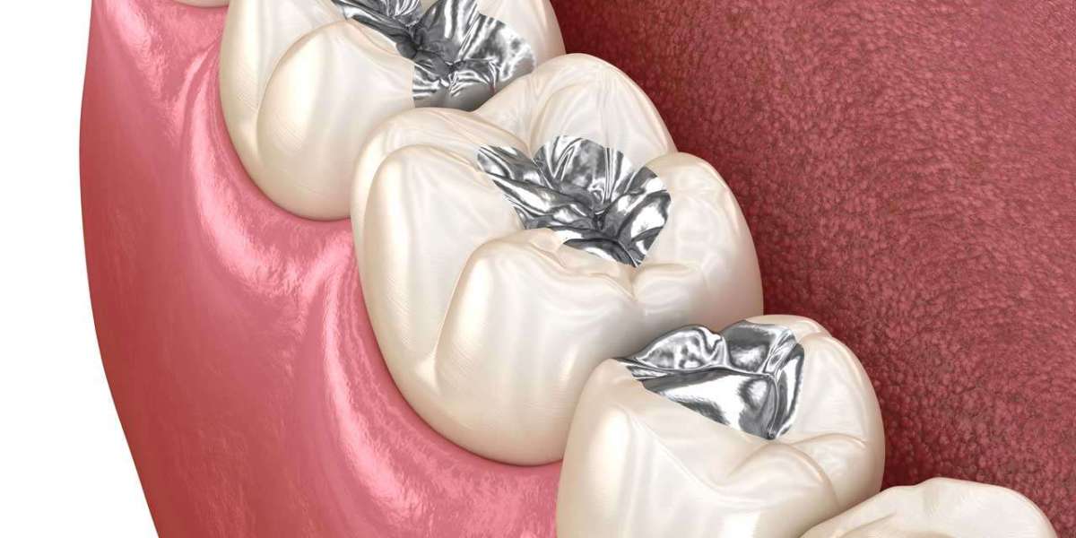 Preventing Damage to Your Dental Tooth Filling