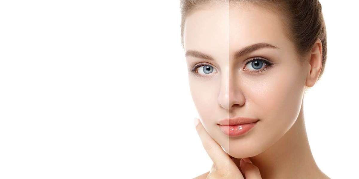 Can Skin Whitening Treatment Cost Unlock Soft, Smooth Skin For Flawless Bright Appearance