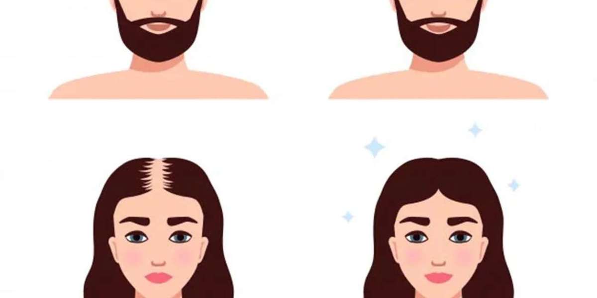 hair patches in hyderabad