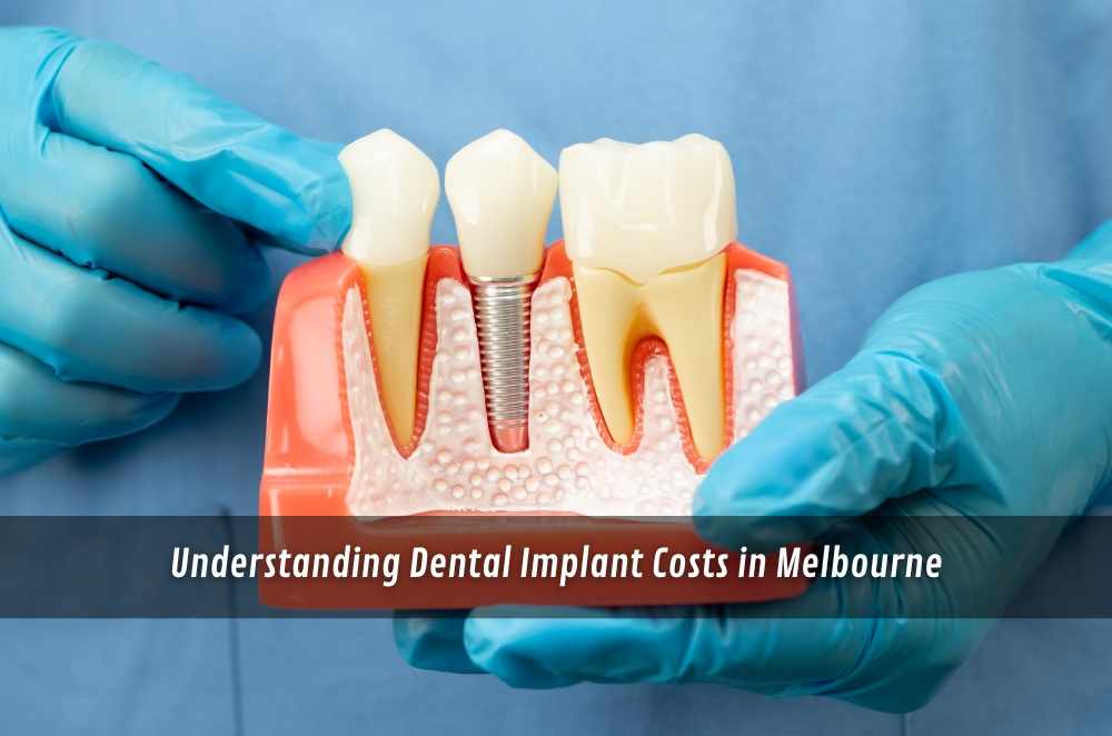 Understanding Dental Implant Costs in Melbourne