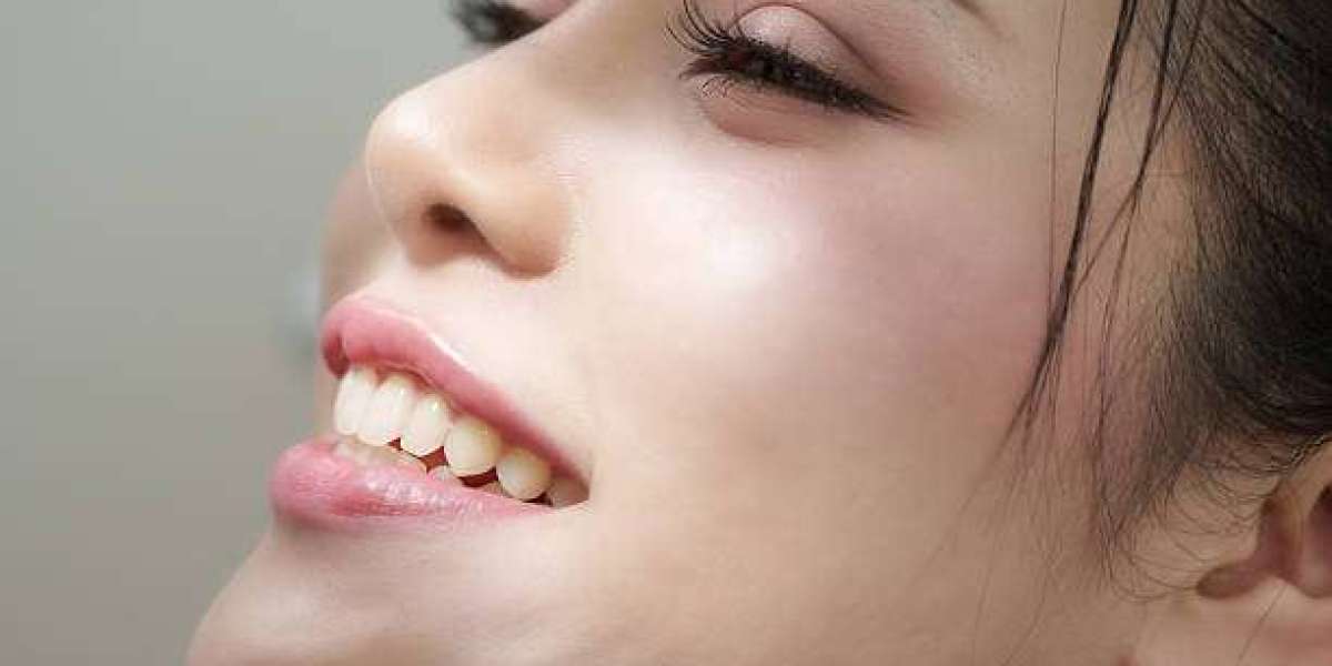 Brighten Your Smile with a Cosmetic Dentist in Islamabad