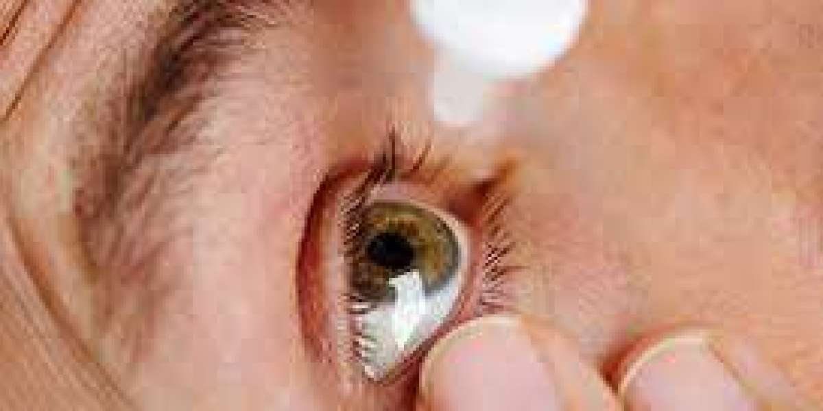 Dry Eye Syndrome Market Opportunities Expanding Through Innovation and Strategic Collaborations Globally