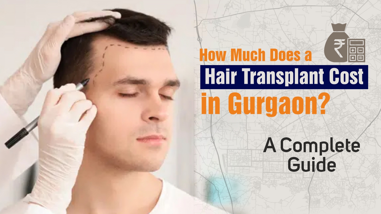 Hair Transplant in Gurgaon | Cost, Procedure & Results Guide