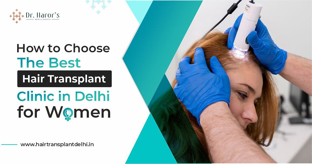 Factors Determining Hair Transplant Cost in Delhi, India