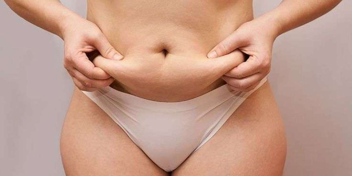 Can Liposuction Treat Double Chin Effectively?