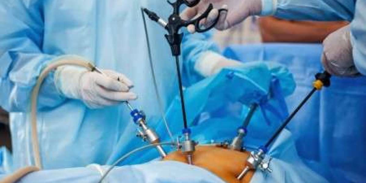 Laparoscopic Surgery in Hapur – Safe and Advanced Surgical Treatment