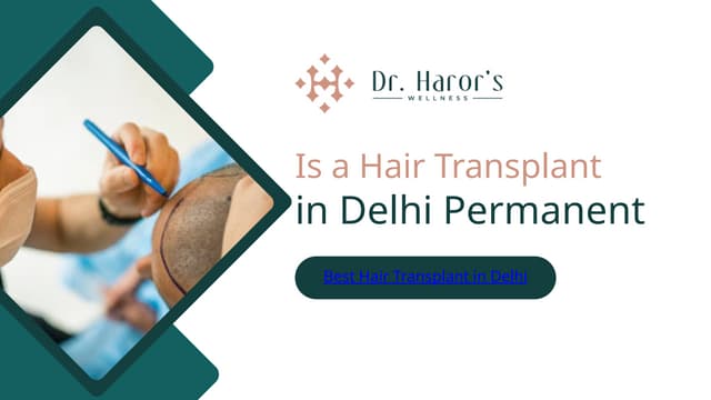 Is a Hair Transplant in Delhi Permanent? | PPTX