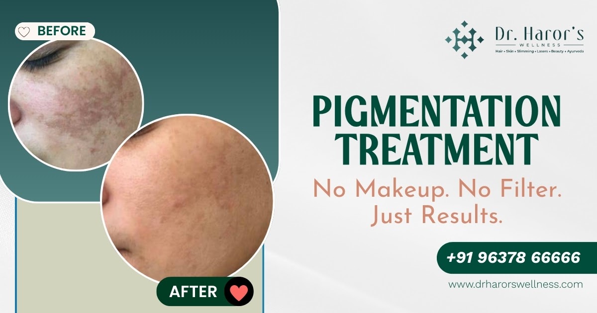Professional Pigmentation Treatments by Dr. Vineeta Pathak – The Best Skin Specialist in Delhi