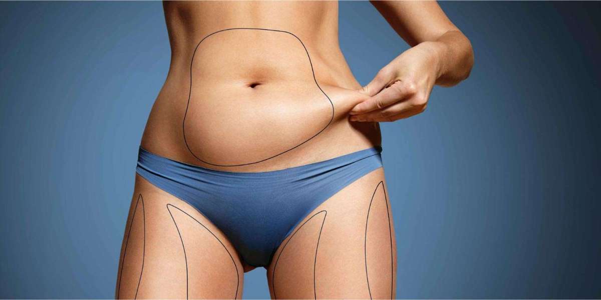 Before and After Results from the Best Tummy Tuck Surgeon in Dubai