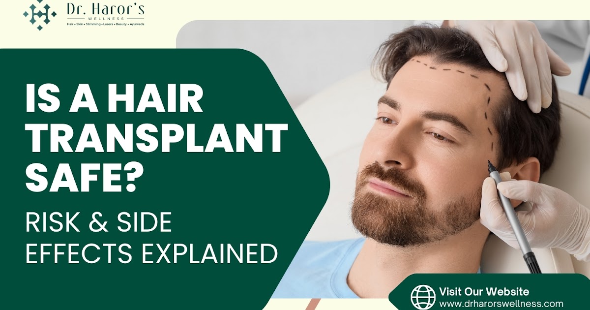 Is a Hair Transplant Safe? Risk & Side Effects Explained
