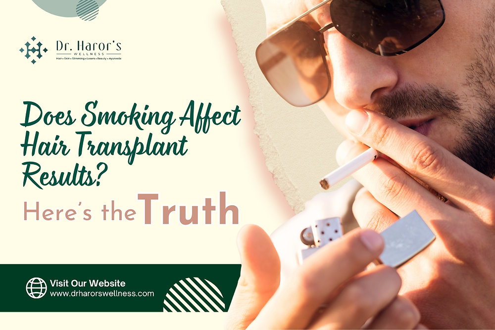 Does Smoking Affect Hair Transplant Results? Here’s the Truth