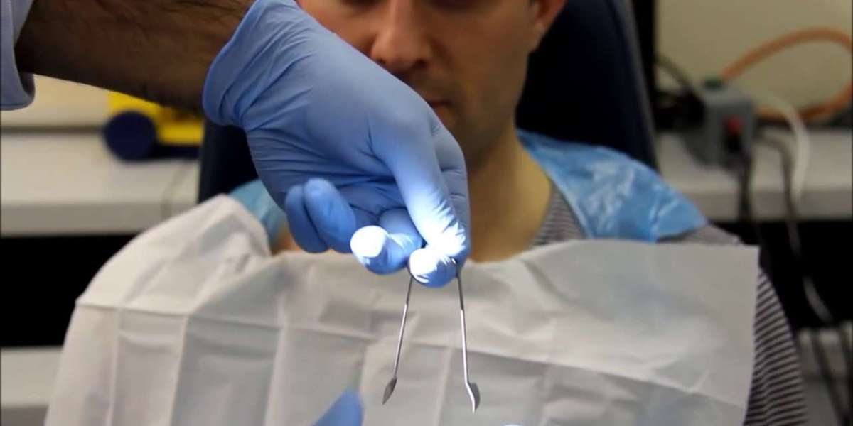 Foreign Body Removal Treatment by Trained Medical Staff