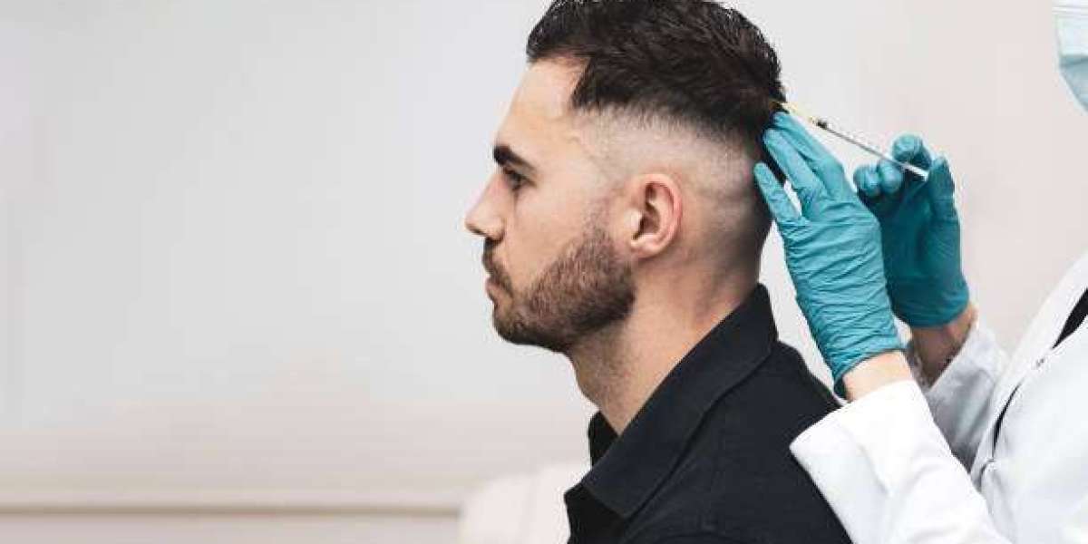 Hair Transplant: A Comprehensive Guide to Modern Hair Restoration