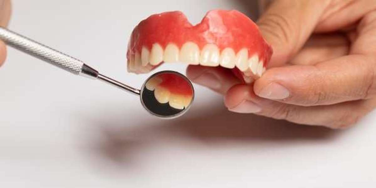 Dentures: Enhance Your Smile and Life Understanding Their Fabrication Process