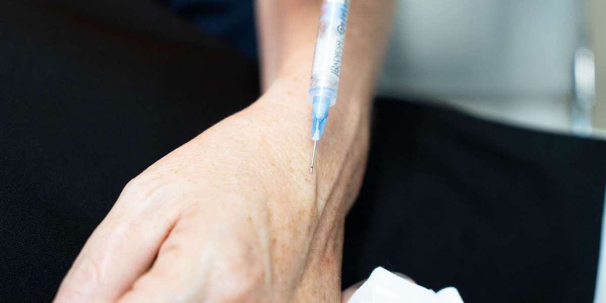 CO2 Hand Rejuvenation Procedure for Hand Skin Renewal