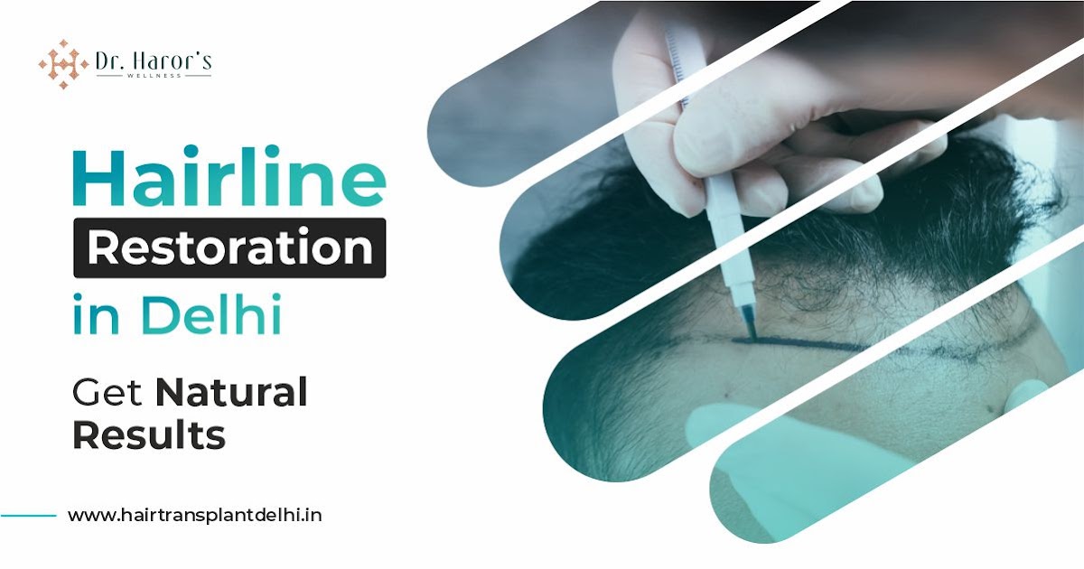 Best Techniques for Hairline Restoration in Delhi That Deliver Natural Results