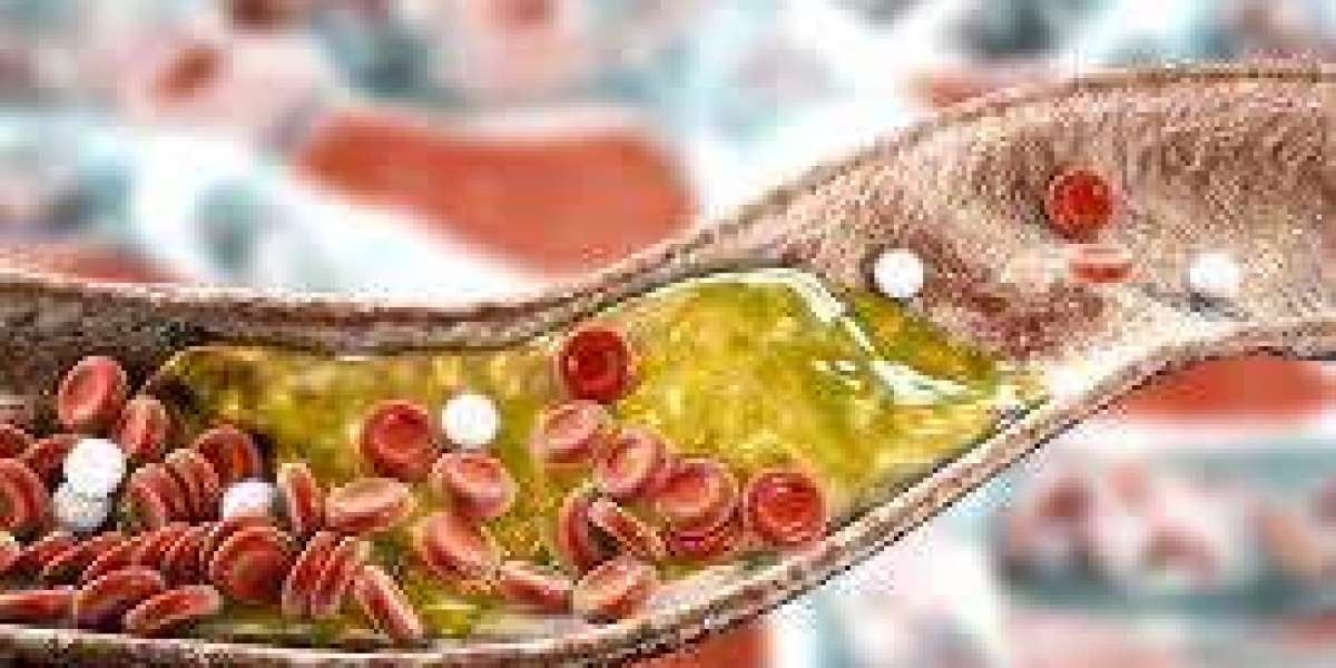 Atherosclerosis drugs market landscape mapping key players pipelines and market shares