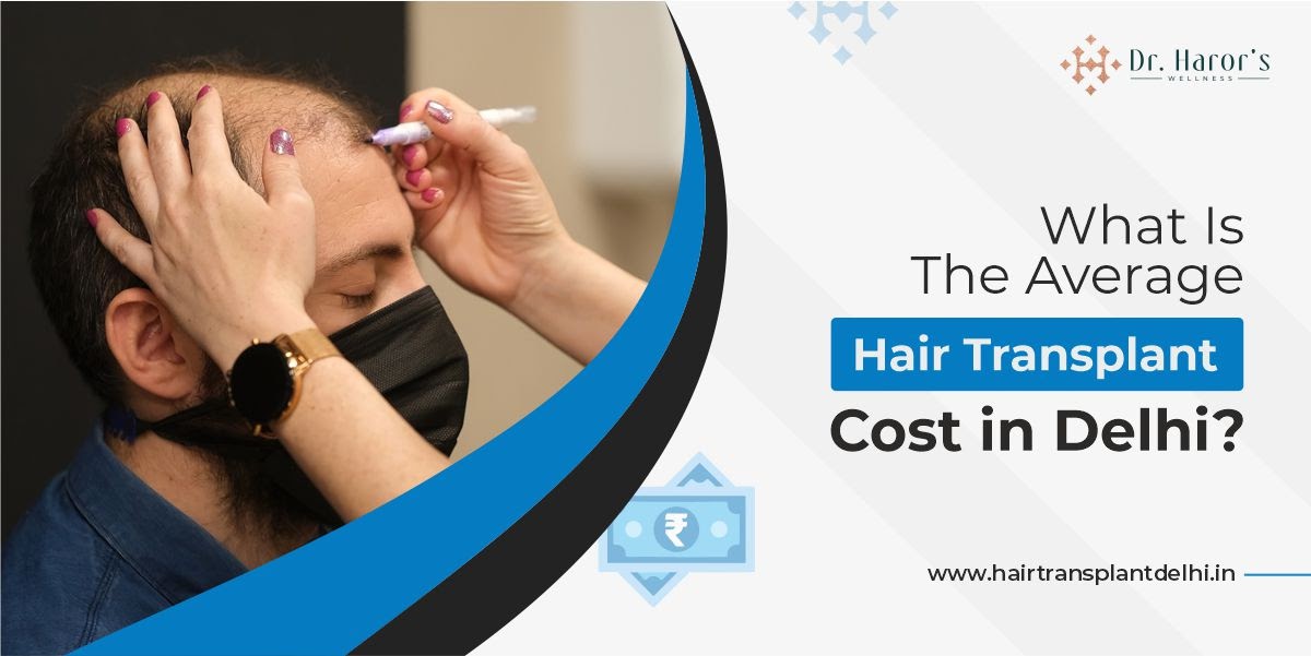 What Is The Average Hair Transplant Cost in Delhi?