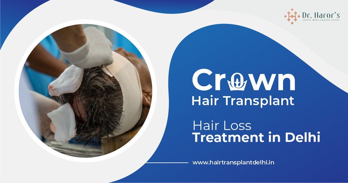 Hair Transplant Clinic in Delhi, India