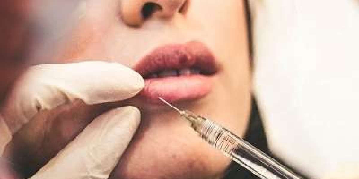 Lip Injections in Riyadh Expert-Led Treatments