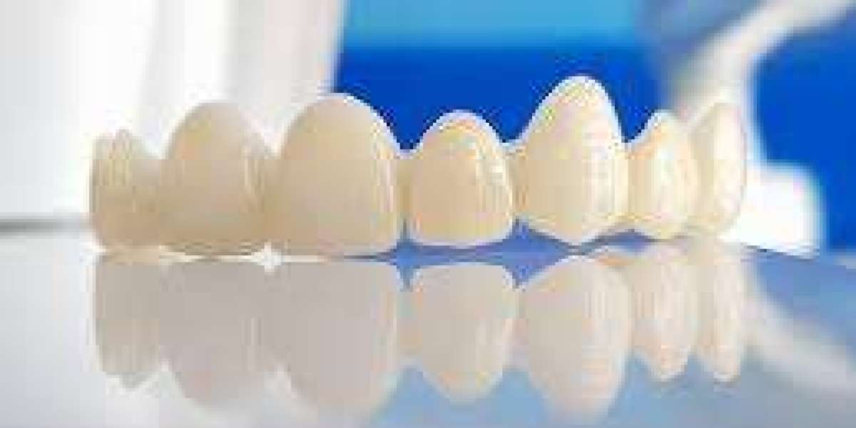 Dental Crown Dubai Procedure Explained Step-by-Step