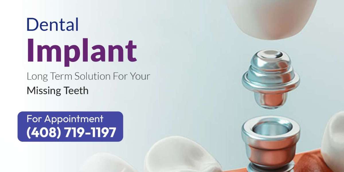 Dentist in Milpitas You Can Trust for Complete Family Care