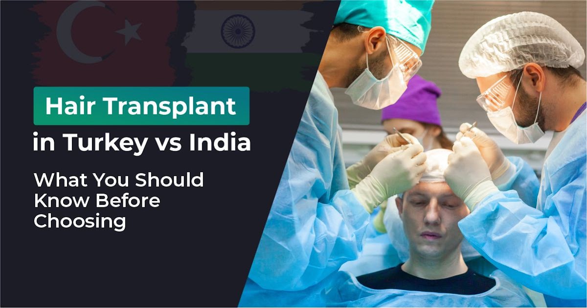 Hair Transplant in Turkey vs India: What You Should Know Before Choosing
