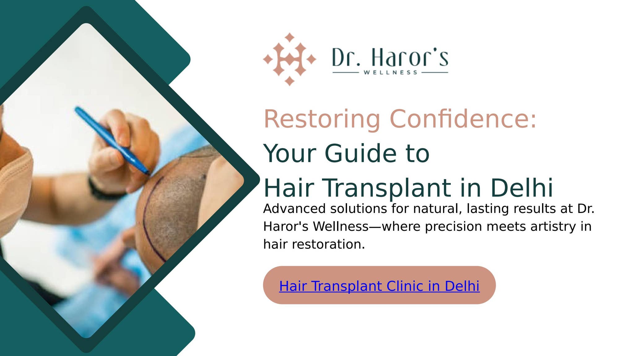 Best Hair Transplant in Delhi by Dr. Haror's Wellness - Issuu